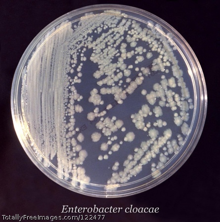 After 24 hours, this trypticase soy broth (TSB) agar showed both